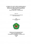 Gambaran Plasenta Previa Berdasarkan Paritas, Usia Ibu, Dan Riwayat Abortus Di Bangsal Obstetri Dan Ginekologi Rs Dustira Cimahi Periode 1 Januari 2014 - 31 Desember 2016